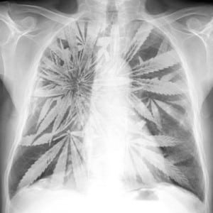 marijuana lung cancer